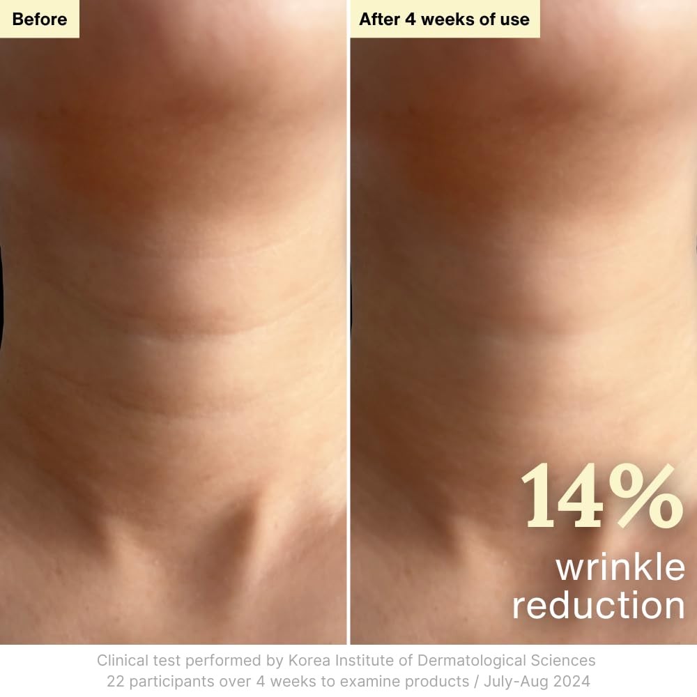 Rothea Resilience Cream, Anti-Aging with Bakuchiol 10,000ppm (Natural Retinol Alternative), Face Moisturizer, Neck Cream with Collagen, Ceramides, Peptides, Niacinamide, Korean Skin Care, 1.7 oz