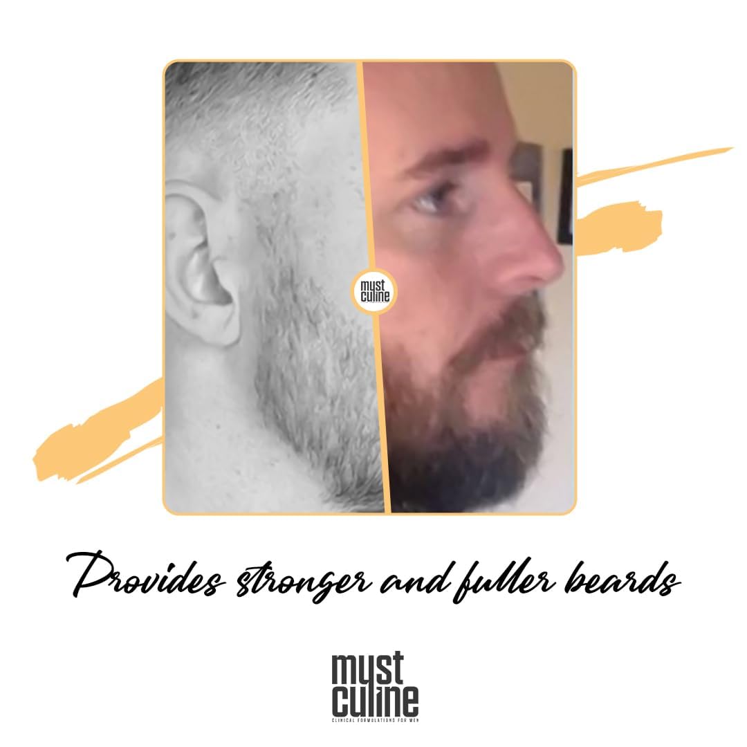 Beard Root Vitamin Spray, 4 Pack, Unscented, Supports Beard and Moustache Growth and Strengthening, Increases Elasticity, Prevents Breakage, Volumizes