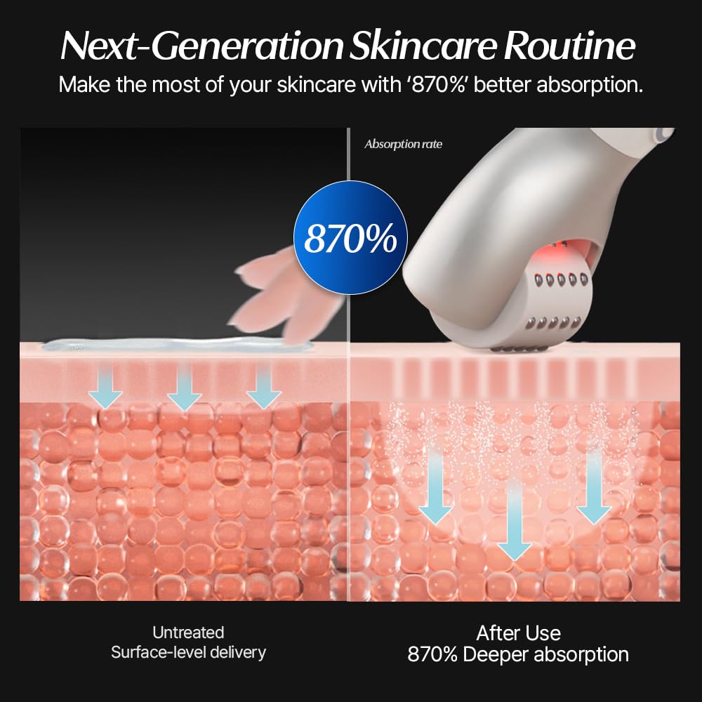 CELORABY Potension Penta-Shot Glass Skin Glow Booster | 5-in-1 Korean Skincare Device for Pore Minimizing, Black Head Care, Enhanced Absorption & Needle-Free Professional Treatment at Home