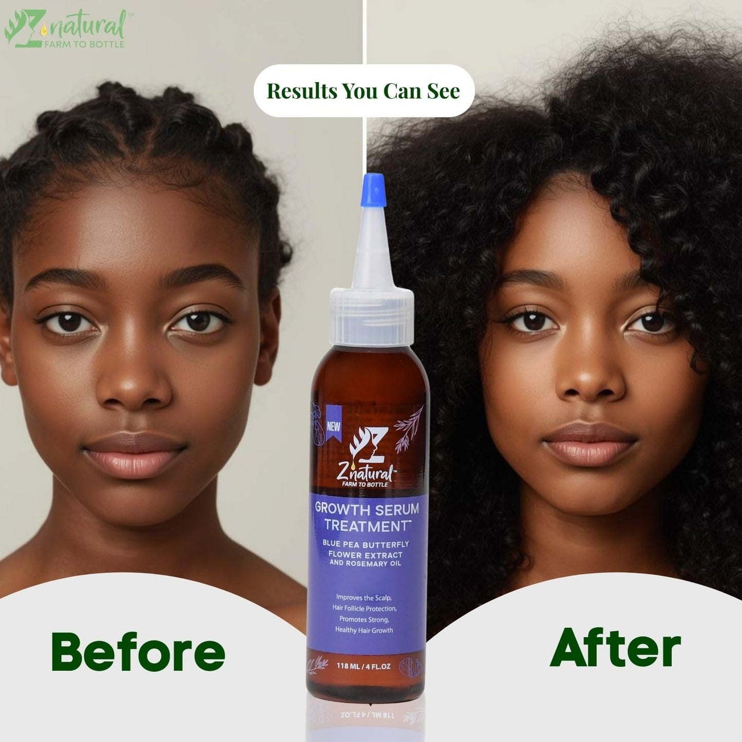 Z’Natural Scalp Hair Growth Treatment Oil – Natural Hair Oil with Blue Pea, Rosemary, Hibiscus, Jasmine & Moringa – Strengthens, Nourishes & Revitalizes Hair – Organic Oils 4Fl Oz