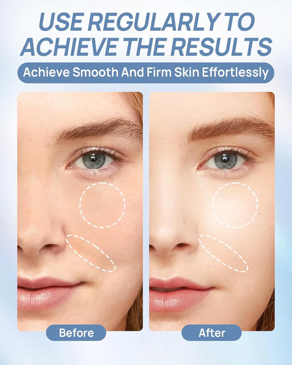 6 Pcs Bio-Collagen Face Mask, Overnight Hydrating Hydrogel Face Masks for All Skin Types - Fine Lines, Elasticity, Pore Minimizing, Firming, Glass Skin Korean Skin Care