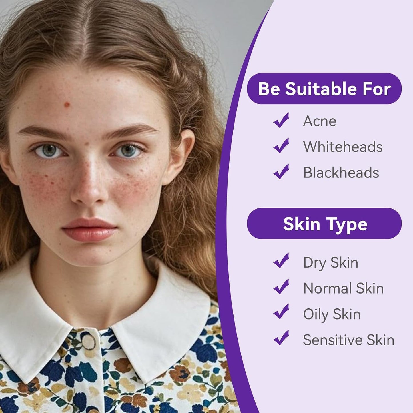 Overnight Pimple Patches for Face - Maximum Strength Hydrocolloid for Cystic Acne & Dark Spots (72 Count) - 10mm & 12mm Medicated Night Time Treatment