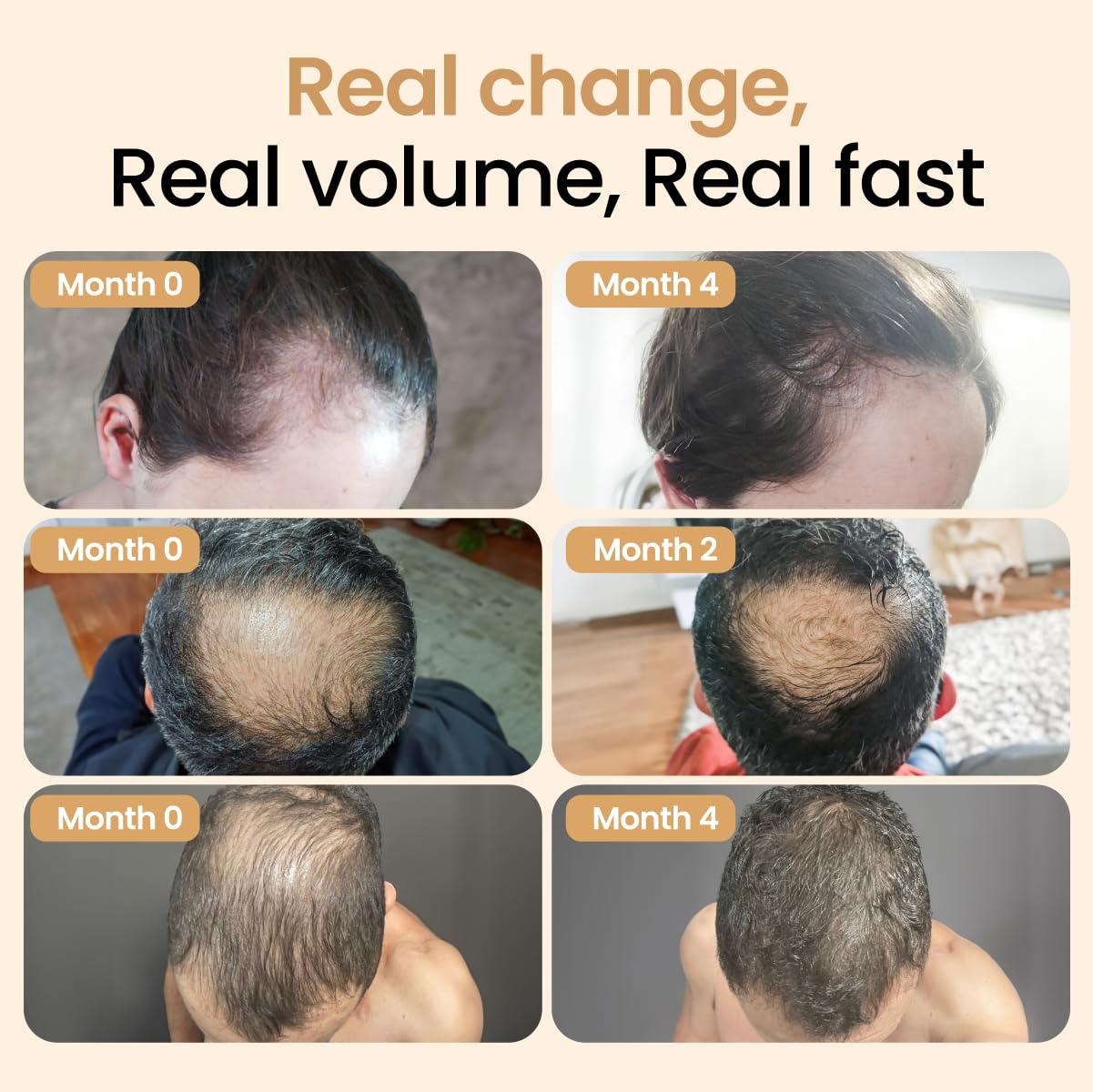 Hair Booster for Women & Men – Hair Revitalizing Serum with Capilia Longa & Arginine for Thick, Dry, Long, Damaged Hair – Peptide-Enriched Hair Tonic, 2 Fl Oz