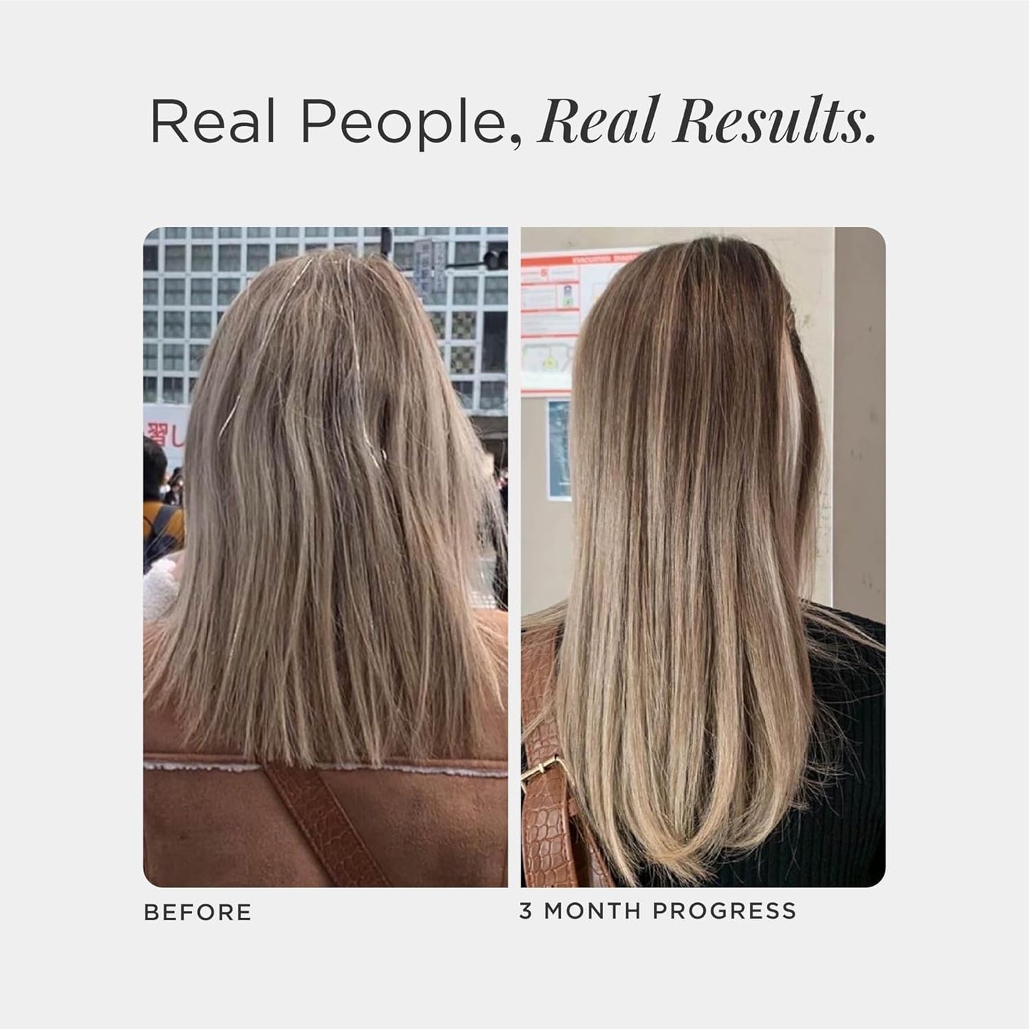 JSHealth Vitamins Hair and Energy Formula - Hair & Scalp Support Supplement with Iodine and Zinc - 30 Capsules