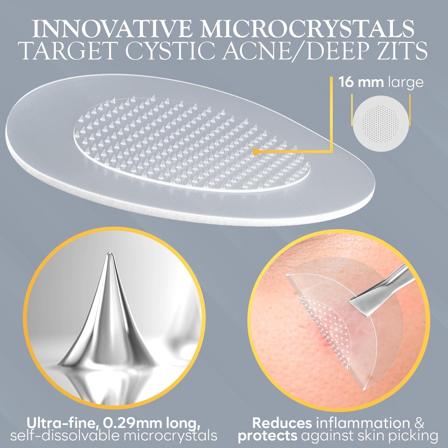 Microdart Acne Patch, Zit Patches for Cystic Acne Overnight Care, Cystic Acne Coverage, Pimple Patches Microdart Technology - Salicylic & Hyaluronic Acid (12 Count)