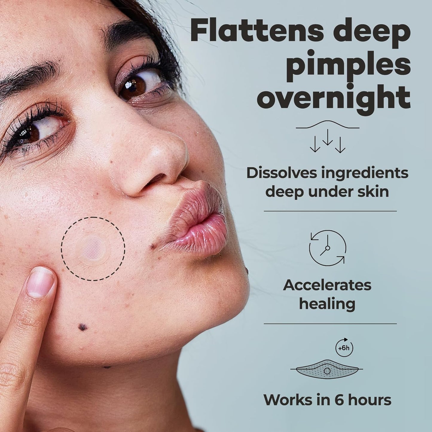 OMMA 72 Patches Pimple Patches for Face and 18 Micropoint Acne Patch Bundle