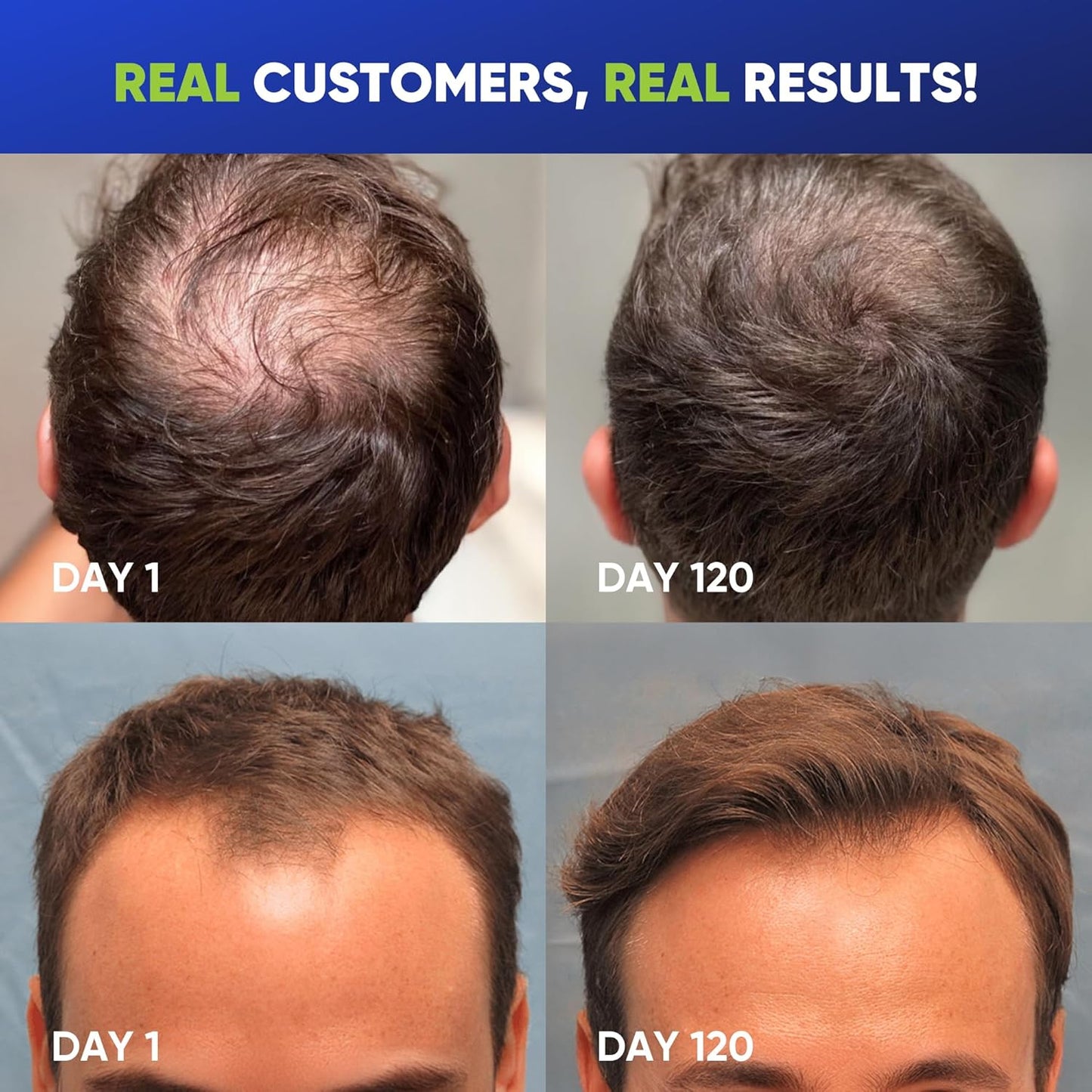 Hair Growth Shampoo for Men - Biotin Thickening Shampoo with Rosemary Tea Tree Oil Caffeine for Hair Loss and Thinning - 13.5 Fl Oz (Pack of 1)