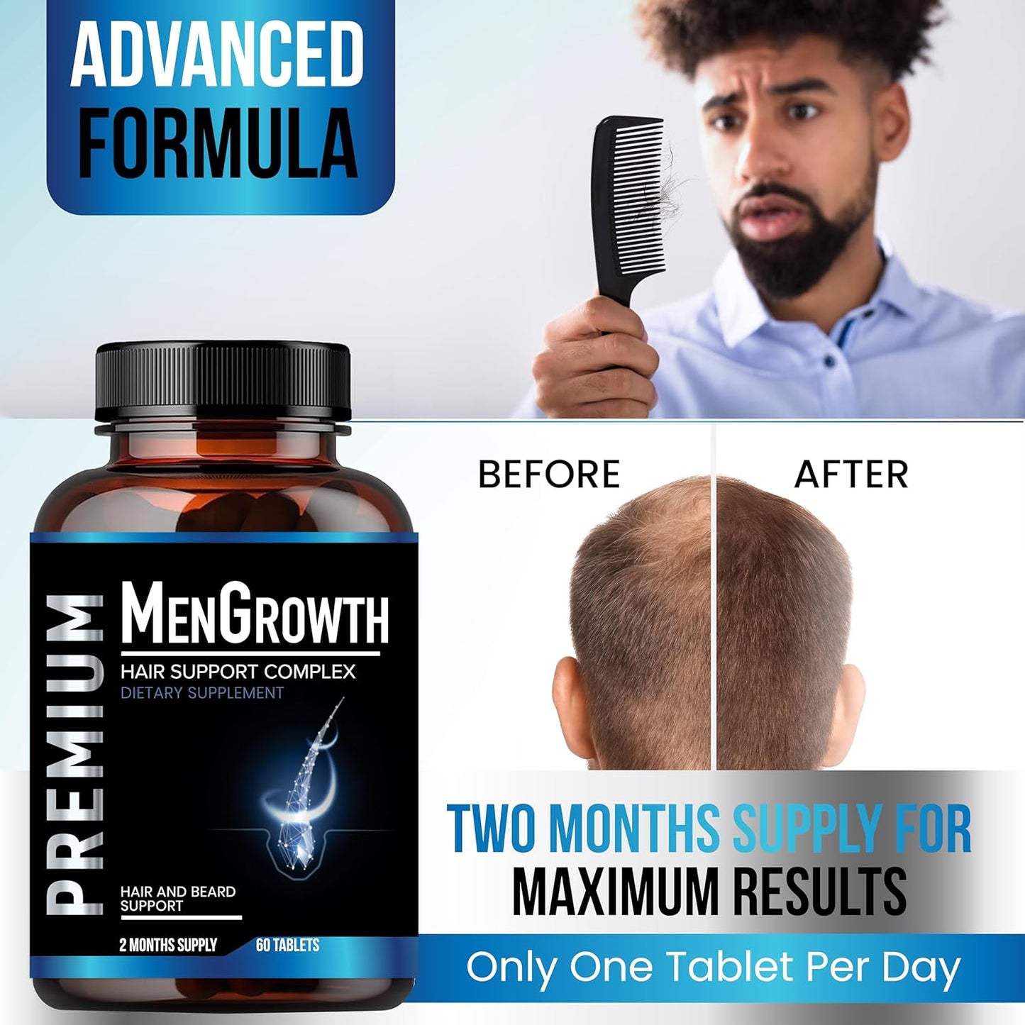 Mens Hair Growth-Hair Vitamins For Men. Anti Hair Loss Supplement, Regrow Hair & Beard Growth Pills With DHT Blocker For Thinning Hair & Hair Thickening With Biotin & Saw Palmetto.Thicker Fuller Hair