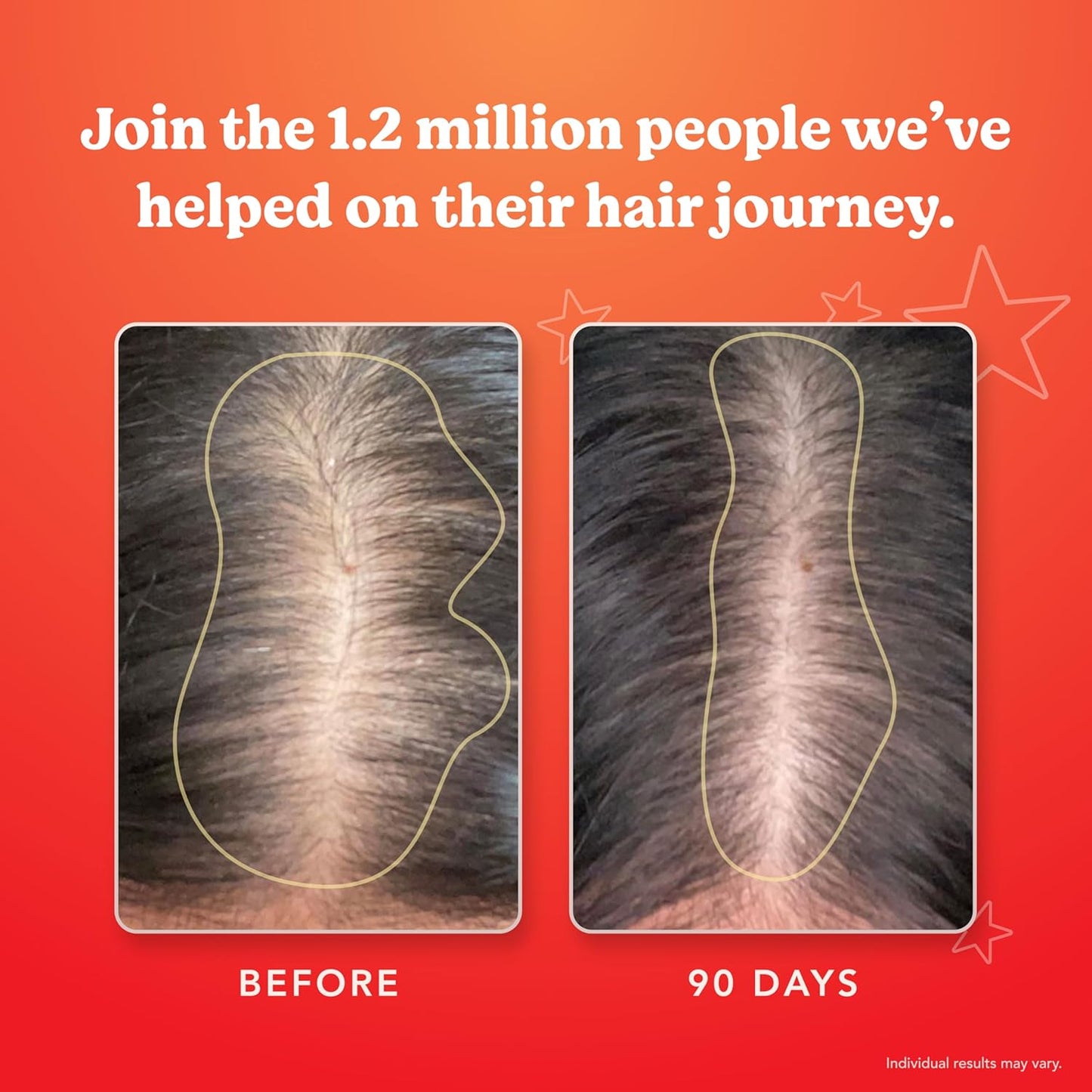 HAIRtamin Advanced Formula Hair Growth Supplement for Women & Men, Supports Stronger, Longer, Visibly Thicker Hair, With 5000 mcg Biotin, Vitamins & Antioxidants, 100% Vegan – 1 Month Supply