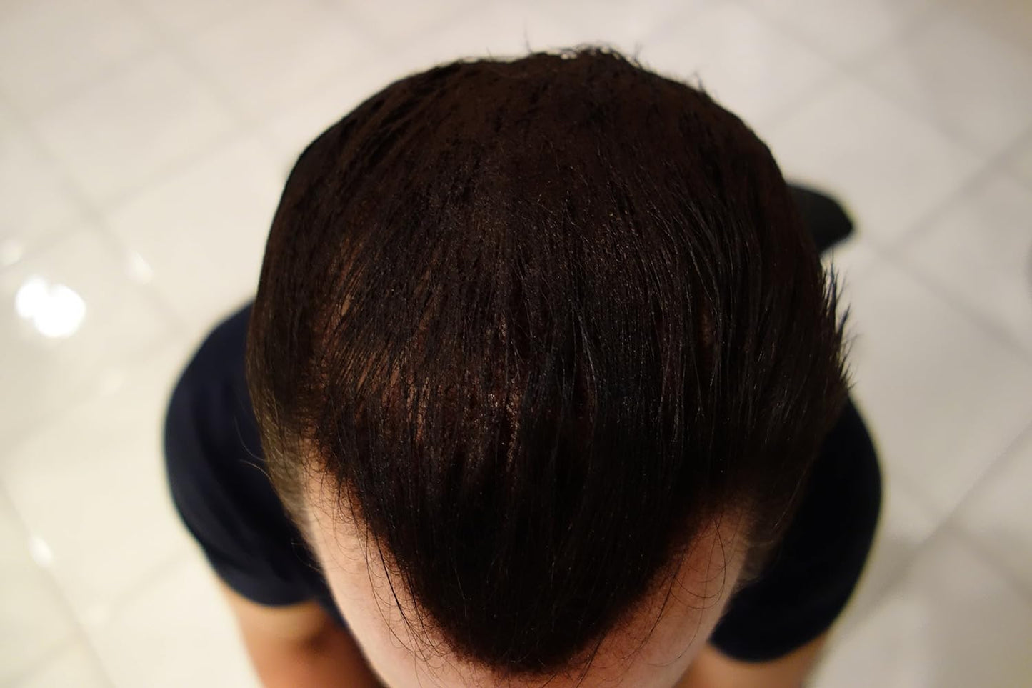 Finally Hair Building Fiber Refill 100 Grams Dark Salt & Pepper For Hair Loss Concealing by Finally Hair (Dark Salt & Pepper)