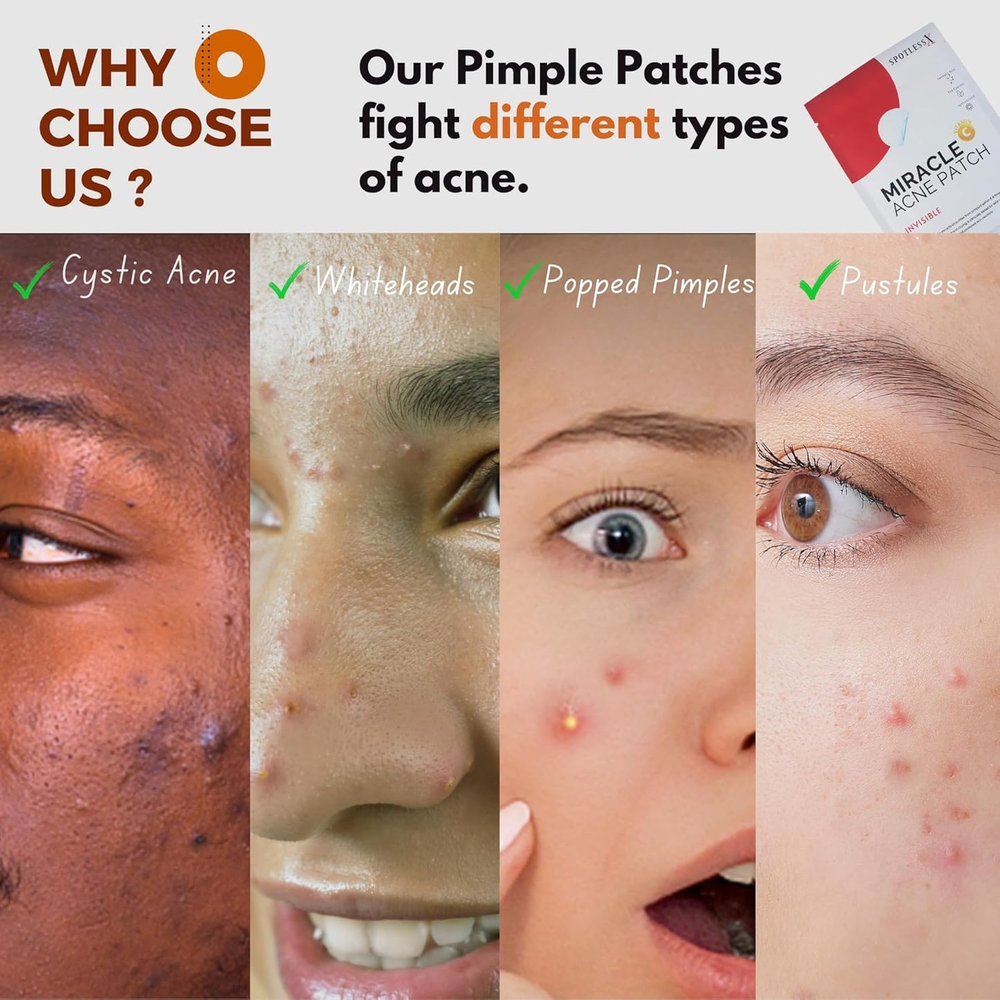 Miracle Patch - Invisible Pimple Patches for Face & Body,Fast-Acting Zit Stickers, Hydrocolloid Acne Treatment with Tea Tree Oil & Salicylic Acid–Waterproof, Hypoallergenic. 96 Counts 3 Sizes