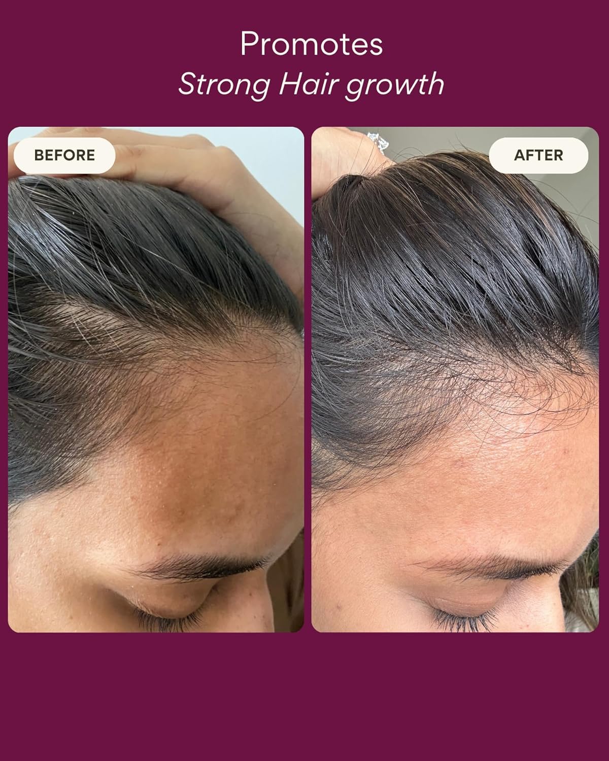 Hair Growth Oil | Natural Hair Regrowth Rosemary Oil for Hair Growth | Scalp & Hair Loss Treatment for Dry, Damaged Hair for Women & Men, 100 ml