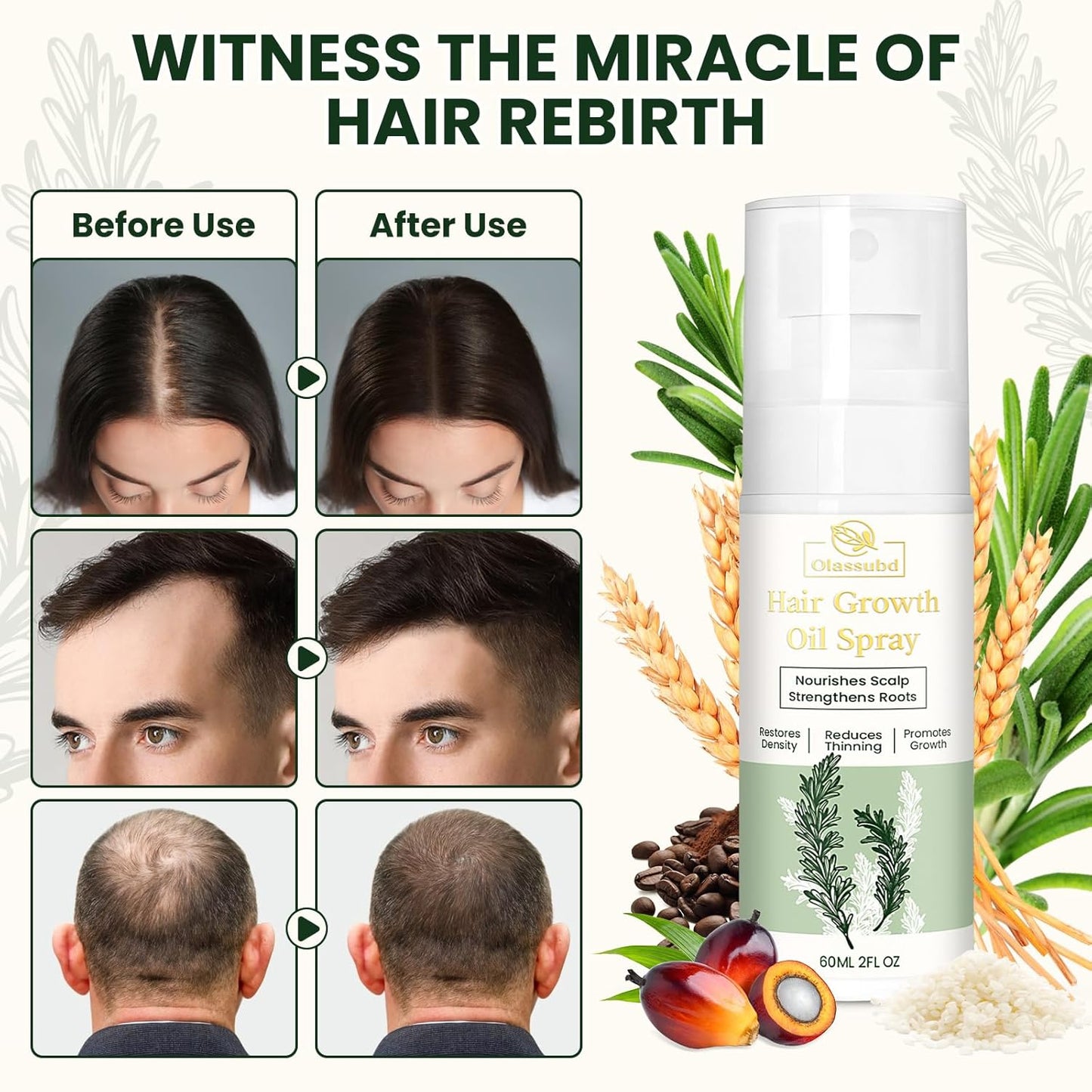 Hair Growth Oil Spray with Rosemary Batana Oil Biotin Caffeine for Hair Growth Spray Anti Hair Loss Repair of Sparse Hair for Women Men 2 Bottles 2 FL OZ Each